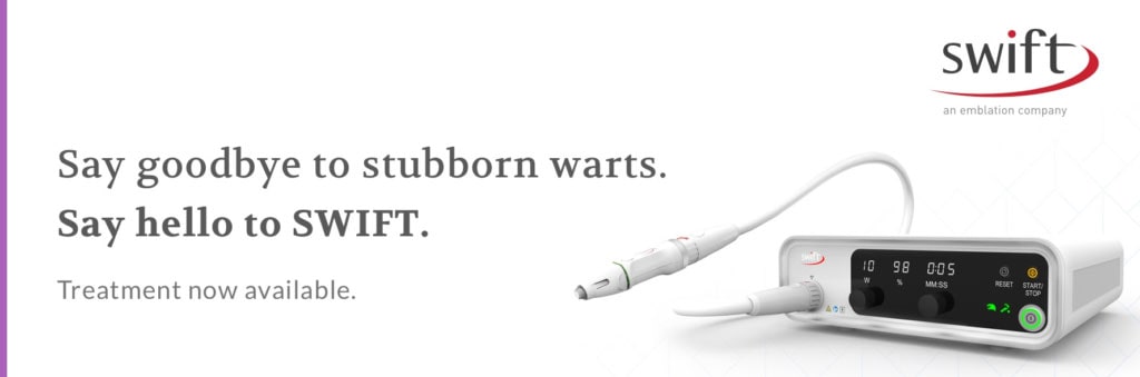 Swift Stubborn Warts